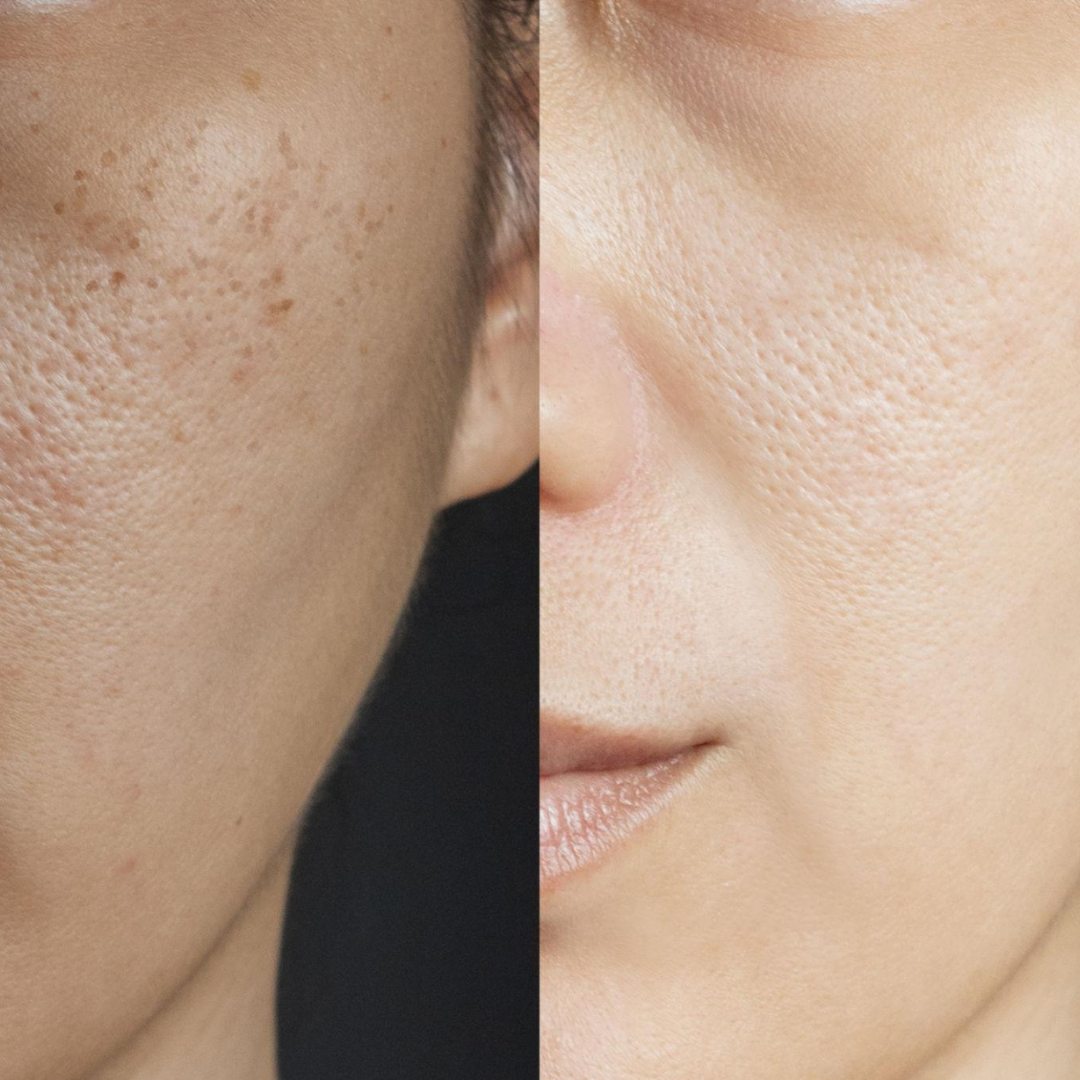 PRACTS Fade & Brightening Cream-DE V2